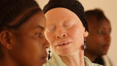 Sabina of Tanzania Albinism Collective. Photo by Marilena Delli