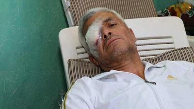 Abdullah El Hajj at the hospital after being shot in the eye. Courtesy Abdullah El Hajj
