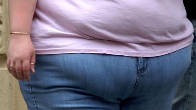 The report comes at a time when awareness is growing over how obesity often correlates with severe Covid-19. PA