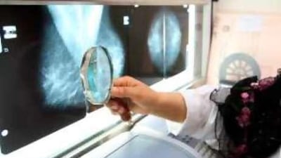 Breast cancer is the most common form of cancer in the UAE.