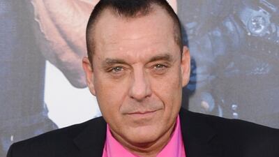 Tom Sizemore is in critical condition after suffering a brain aneurysm. AP