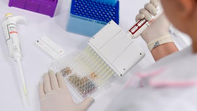 The world must invest in vaccine development to prevent another pandemic. AFP