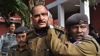 An Indian policeman is helped by colleagues after being attacked by a leopard in the Maligoan area of Guwahati. Two people were injured in the attack before the animal was tranquilised and taken to Assam state zoo. Biju Boro / AFP