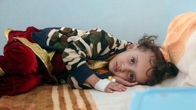 A child at a treatment centre for malnutrition in the country's third largest city of Taez, on November 24. AFP