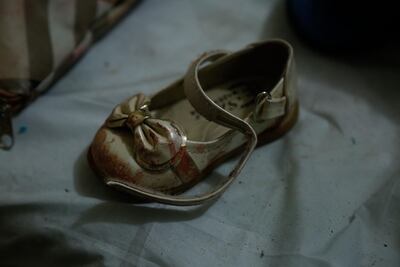 The shoe of a Syrian girl who was injured in the shelling in Misraba. AFP PHOTO / HASAN MOHAMED