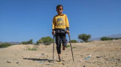 Twelve-year-old Alaa Hassan elies on wooden walking sticks to move around. Photo: Project Masam
