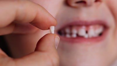 Milk teeth are being used to harvest stem cells for future health treatments. Getty Images