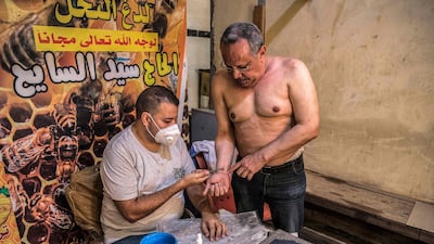 Sayed Al Sayeh uses tongs to clasp a bee stinging the wrist of a patient at his Giza practice. He provides his services free of charge. AFP