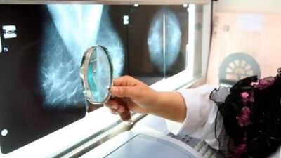 Dr Jalaa Taher looks at chest x-rays at the National Health Screening Program for Women and Children, part of the Ministry of Health. She and several other doctors are part of a global initiative to promote breast cancer awareness. Nicole Hill / The National