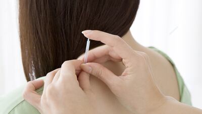 The doctors at Zabeel Ladies Club use acupuncture needles to ease discomfort. iStock