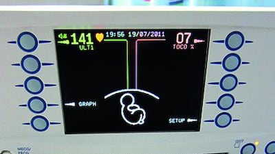 Maternity fetal heart monitor. Getty Images