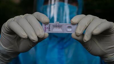 A health worker shows a sample kit of a Covid-19 positive test during a door-to-door test drive in Gauhati, India. AP Photo