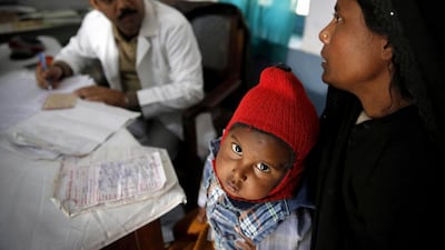 Anwar, 4, a tuberculosis patient, at a check-up in Kotawa near Varanasi in Uttar Pradesh. Rajesh Kumar Singh / AP Photo