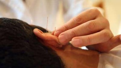 The needles used in acupuncture do not break a fast, the department said.