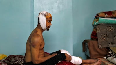 Mohammad Zubair, 37, who is Muslim and was injured after being beaten by a group of men during protests sparked by a new citizenship law. Reuters