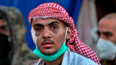 An injured paramedic prepares to help injured protesters during clashes between security forces and anti-government protesters near Baghdad's Khilani square, Iraq. AP Photo