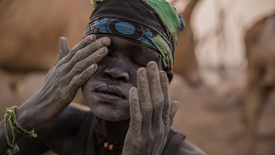 A Sudanese boy covers his face with ash, which acts as a mosquito repellent.