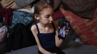 After months of suffering, she lost most of her hair, was unable to walk and suffered from regular seizures. AFP