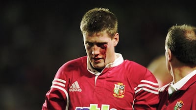 In this file photo from June 23, 2001 Ronan O'Gara, the British & Irish Lions fly-half, leaves the field bleeding after an assault by Duncan McRae of the NSW Waratahs during a tour match at Sydney Football Stadium in Sydney, Australia. Dave Rogers / Getty Images