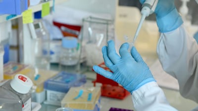 An Abu Dhabi hospital has administered the first dose of Itvisma, in a milestone success for the country's health sector. AFP