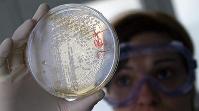 Examining E. coli after an outbreak in Spain in 2011. Francisco Bonilla / Reuters