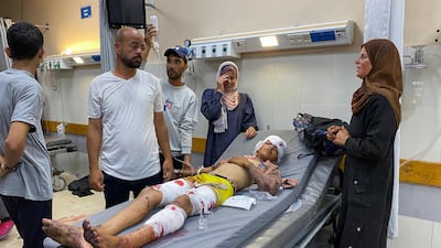 A Gazan injured in Israeli fire near a food aid centre is treated at Nasser Hospital. AFP