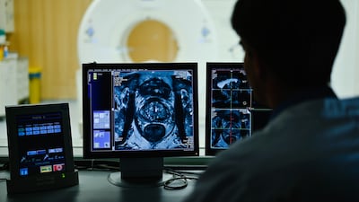 Medics view a cross-sectional image of a prostate on the monitor. Getty Images