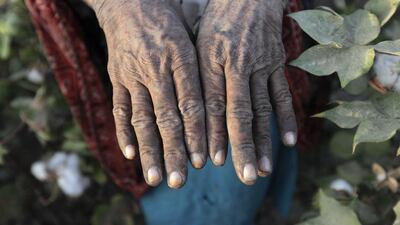A cotton picker toils in the fields in Meeran Pur village, north of Karachi; a picker displays her rough hands; women make up the bulk of Pakistan’s 500,000 cotton pickers, most working for less than 7 dirhams a day. Akhtar Soomro / REUTERS