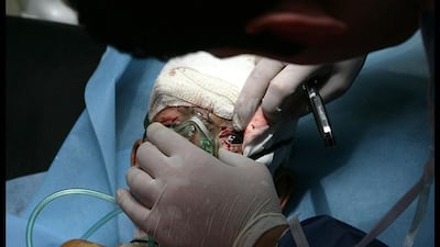A medic checks a wounded child at a hospital in the northern city of Dohuk , Iraq. Safin Hamed / AFP