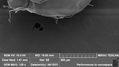 An electron microscope scan of a new type of water flea, called Daphnia arabica, recently discovered in the UAE. Photo: Dr Alexey Kotov