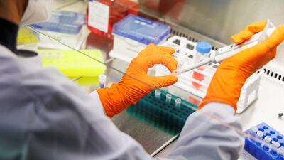 Bavarian Nordic is the only company in the world to have approval for a smallpox vaccine called Jynneos in the US and Imvanex in Europe. It is also effective against monkeypox. Reuters