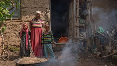 Kasech Fantu is a vegetable merchant who lives in Sankoru, Ethiopia with her two children. She suffers from an advanced stage of lymphatic filariasis that causes the limbs to swell, resulting in severe mobility issues and potentially permanent disability. Photo: Reach Campaign