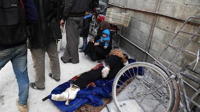 An injured man is evacuated from Arbin in Eastern Ghouta as rebels and civilians leave the opposition enclave on March 26, 2018. Mohammed Eyad / AFP