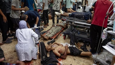 Wounded Palestinians are treated at Nasser Hospital. EPA