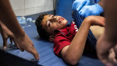 EDITORS NOTE: Graphic content / An injured boy receives treatment at a hospital ward in Khan Yunis in the southern Gaza Strip on July 7, 2026, following a reported Israeli attack in the Mawasi area in Khan Yunis. Violence continues in Gaza despite a ceasefire between Hamas and Israel in place since October 2025. At least 1,072 Palestinians have been killed in the territory since the truce took effect, according to the territory's health ministry, which operates under Hamas authority and whose figures are considered reliable by the United Nations. (Photo by Bashar Taleb / AFP)