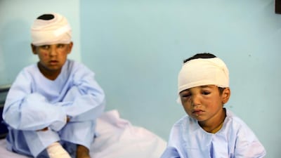 Afghan children receive treatment at a local hospital after a Taliban attack in Farah province on April 4 last year. Aref Karimi / AFP