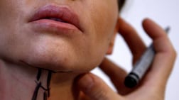 Dubai Health Authority has reinforced rules to protect patients from unrealistic cosmetic promises. Photo: Reuters