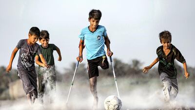 ‘A Desire for Life’ by Iraqi photographer Taisir Mahdi, of a young boy who lost his leg in a terrorist attack. Beirut Image Festival