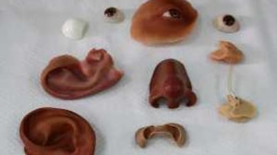 Artificial human parts ready to be used at Al Rashid Hospital's prosthetic restoration unit.