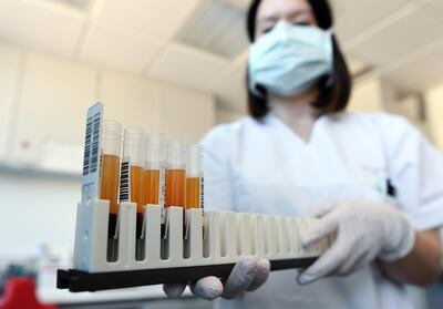 Hospitals in Abu Dhabi and Dubai are treating severe Covid-19 patients with the plasma of those who have recovered. Reuters