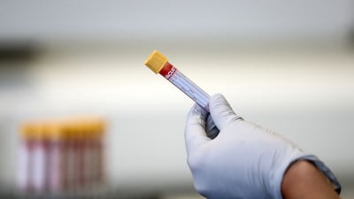 Testing has revealed a rise in HIV infections in the Middle East. PA