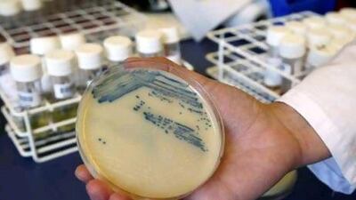 Shown here is a petri dish with methicillin-resistant Staphylococcus aureus (MSRA) cultures at the Queen Elizabeth Hospital in King's Lynn, England. Doctors are calling for urgent action on the spread of the superbug in UAE hospitals.