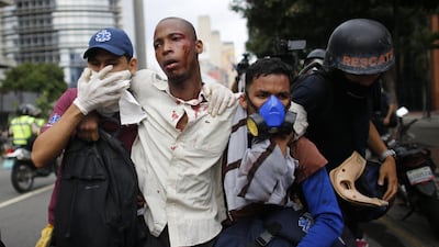 Paramedics assist a man injured during clashes with security forces during protests asking for the resignation of president Nicolas Maduro in Caracas, Venezuela. Ariana Cubillos / AP Photo