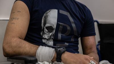 After seven surgeries, the fate of his legs isn’t yet clear - but he hopes they can be saved.