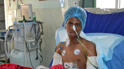 Abdulqader Mubarak,13, had his arm amputated after a Houthi-laid landmine exploded. His mother and sister in law died. Mohammed Al Qalisi for The National