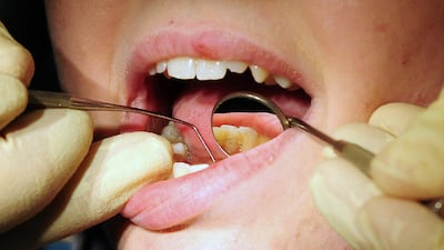 Bupa Dental Care plans to close 85 dental practices in a move that will affect 1,200 staff across the UK. PA
