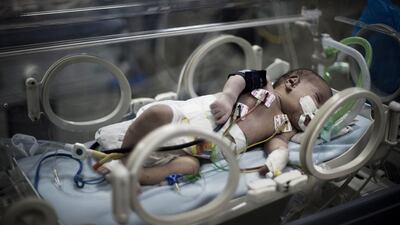 A Palestinian baby lies in the maternity ward at Gaza City’s children’s hospital Al Nasir, which is using solar energy to power its incubators. Mahmud Hams / AFP