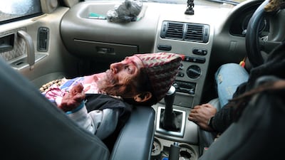 Chandra Bahadur Dangi (C), a 72-year-old Nepali who claims to be the world's shortest man at 56 centimetres (22 inches) in height, rests in car in Dang district, some 540 kilometres southwest of Kathamandu. AFP PHOTO/Prakash MATHEMA