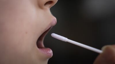 Long Covid can affect the quality of patient's lives more than recovery from certain cancers and as much as Parkinson's disease, a study has suggested. PA