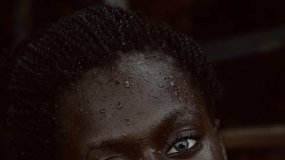 Humid weather affects skin adversely in various ways, say dermatologists. Unsplash